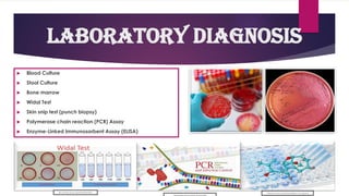 Laboratory Diagnosis
 Blood Culture
 Stool Culture
 Bone marrow
 Widal Test
 Skin snip test (punch biopsy)
 Polymerase chain reaction (PCR) Assay
 Enzyme-Linked Immunosorbent Assay (ELISA)
https://images.app.goo.gl/QVkwjDZei9WZ5FTN6
https://images.app.goo.gl/3rEk1TprzJDuPkqM8
https://www.olmix.com/sites/default/files/17_don_elisa.png
 