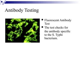 Antibody Testing


Fluorescent Antibody
Test
The test checks for
the antibody specific
to the S. Typhi
bacterium.
 