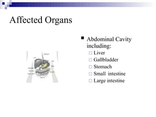 Affected Organs
 Abdominal Cavity
including:
 Liver
 Gallbladder
 Stomach
 Small intestine
 Large intestine
 