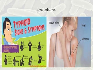symptoms
 