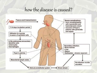 how the disease is caused?
 
