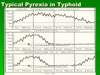 Typical Pyrexia in Typhoid [email_address] 