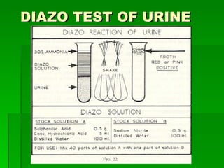 DIAZO TEST OF URINE   [email_address] 