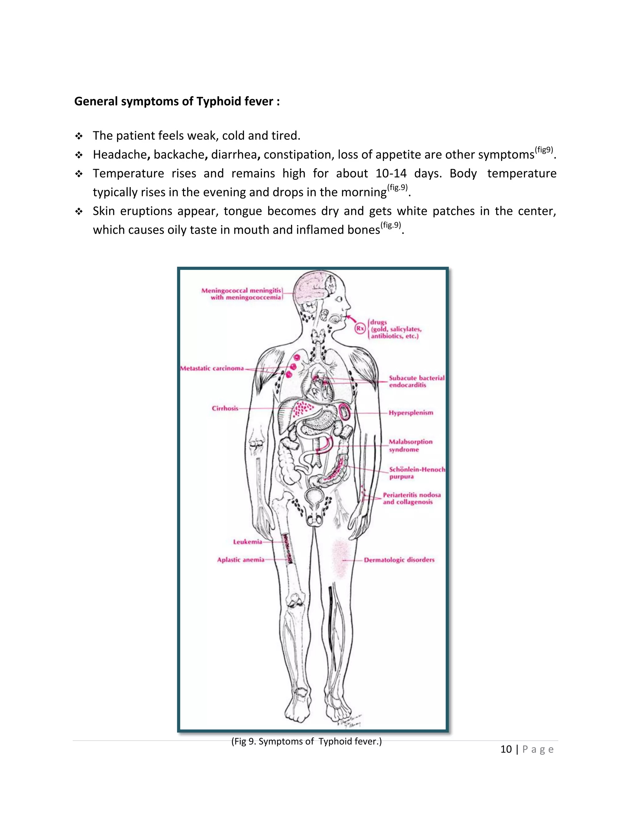 10 | P a g e
General symptoms of Typhoid fever :
 The patient feels weak, cold and tired.
 Headache, backache, diarrhea, constipation, loss of appetite are other symptoms(fig9)
.
 Temperature rises and remains high for about 10-14 days. Body temperature
typically rises in the evening and drops in the morning(fig.9)
.
 Skin eruptions appear, tongue becomes dry and gets white patches in the center,
which causes oily taste in mouth and inflamed bones(fig.9)
.
(Fig 9. Symptoms of Typhoid fever.)
 