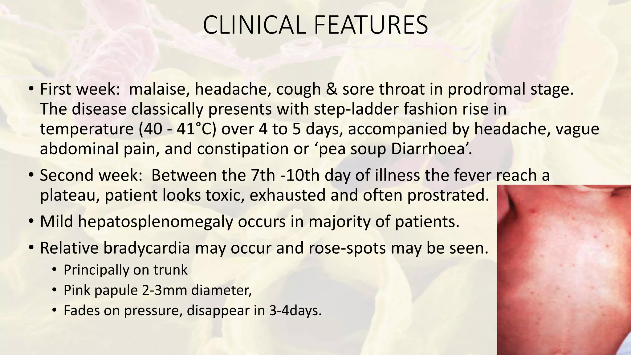 Typhoid fever, Eteric fever, | PPTX | Infectious Diseases | Diseases ...