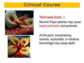 Third week (Cont…)
Necrotic Peyer patches may cause
bowel perforation and peritonitis
At this point, overwhelming
toxemia, myocarditis or intestinal
hemorrhage may cause death.
Clinical Course
 