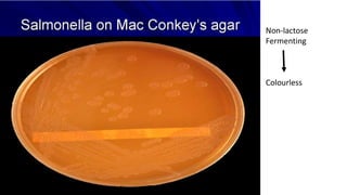 Non-lactose
Fermenting
Colourless
 