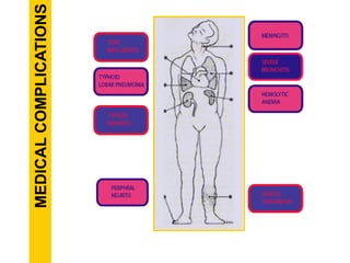 MEDICALCOMPLICATIONS
 