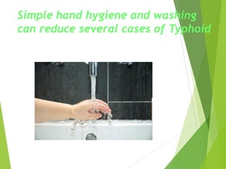 Simple hand hygiene and washing
can reduce several cases of Typhoid
 