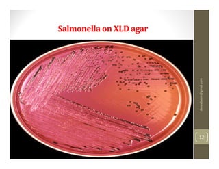 Salmonella on XLD agar




                         deepababin@gmail.com
                         12
 