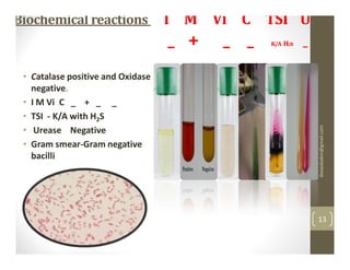 Biochemical reactions              I M Vi C TSI U
                                   _ +   _ _   K/A H2s   _

 • Catalase positive and Oxidase
   negative.
 • I M Vi C _ + _ _
 • TSI - K/A with H2S




                                                             deepababin@gmail.com
 • Urease Negative
 • Gram smear-Gram negative
   bacilli




                                                             13
 