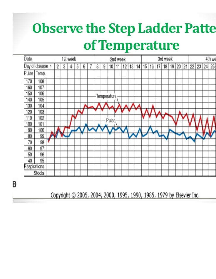 Typhoid fever deepa babin