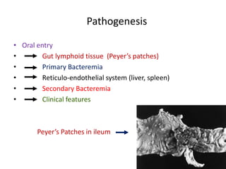 Pathogenesis
• Oral entry
• Gut lymphoid tissue (Peyer’s patches)
• Primary Bacteremia
• Reticulo-endothelial system (liver, spleen)
• Secondary Bacteremia
• Clinical features
Peyer’s Patches in ileum
 