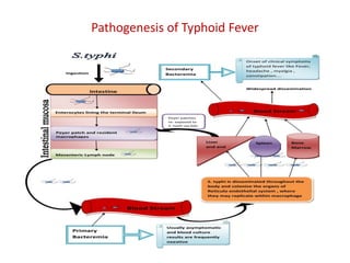 Pathogenesis of Typhoid Fever
 