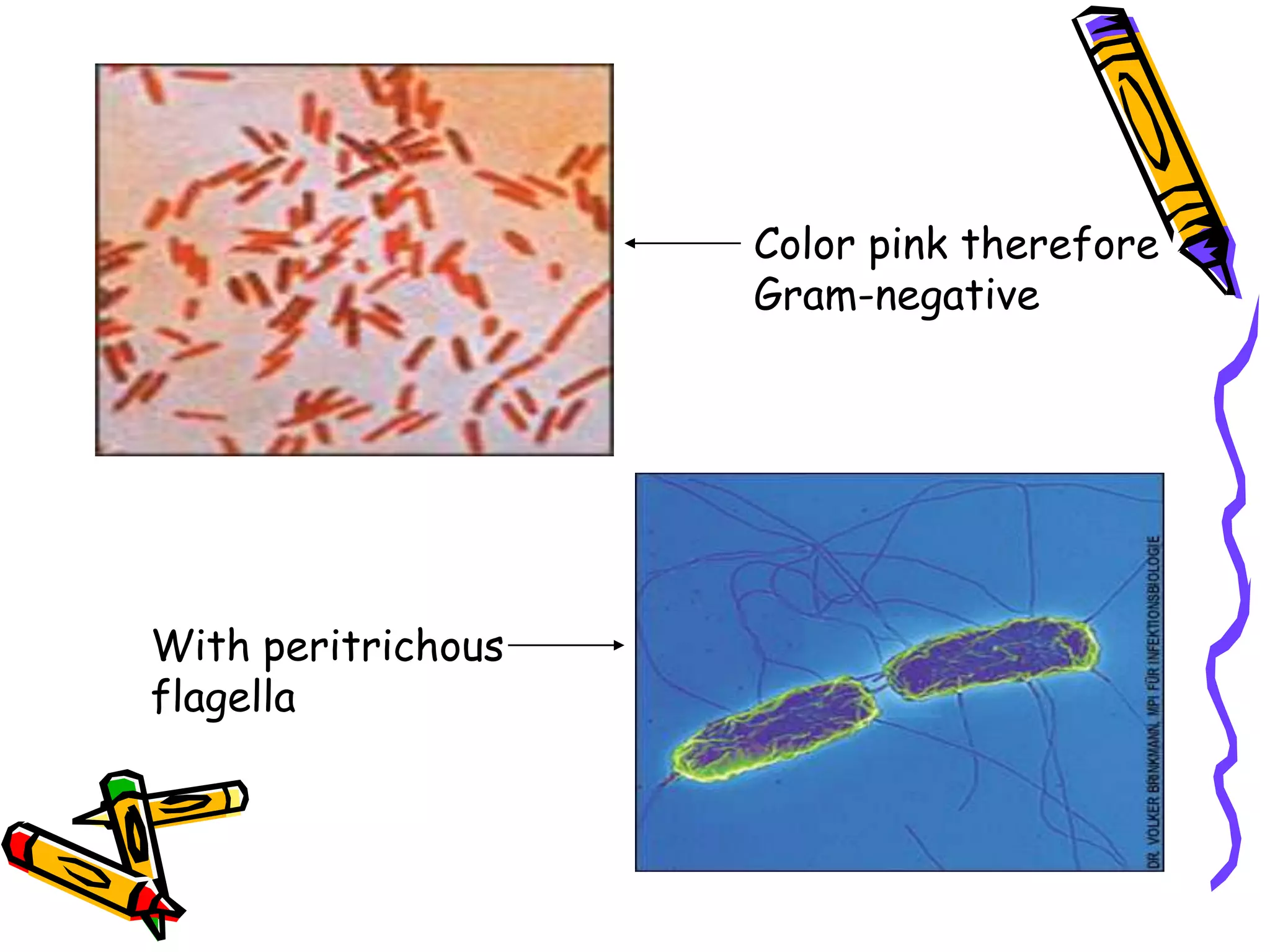 With peritrichous
flagella
Color pink therefore
Gram-negative
 