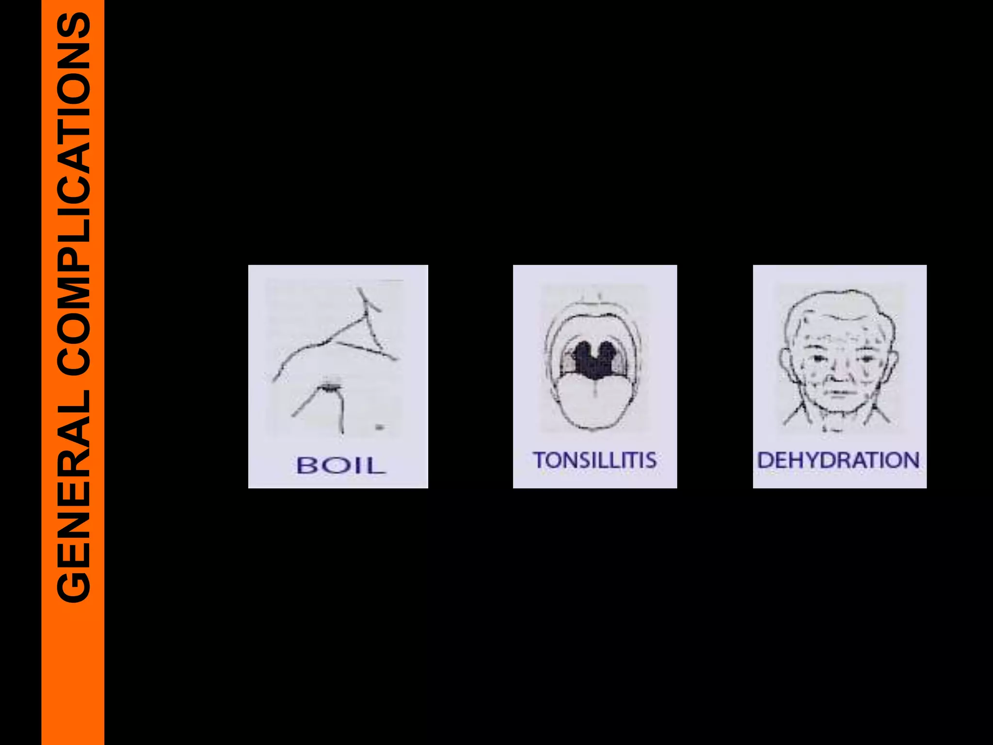 GENERALCOMPLICATIONS
 