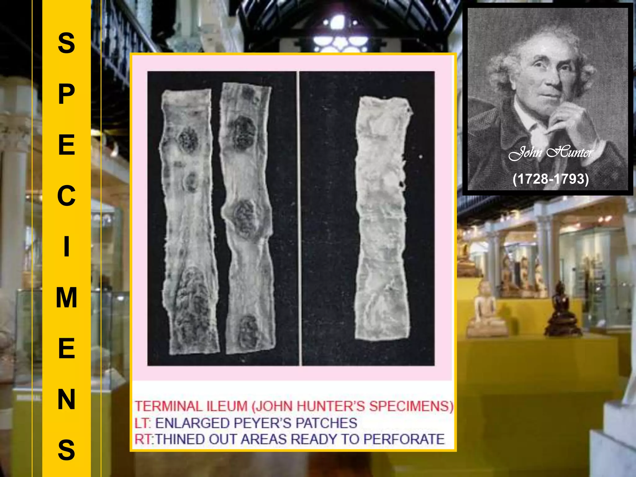 S
P
E
C
I
M
E
N
S
John Hunter
(1728-1793)
 