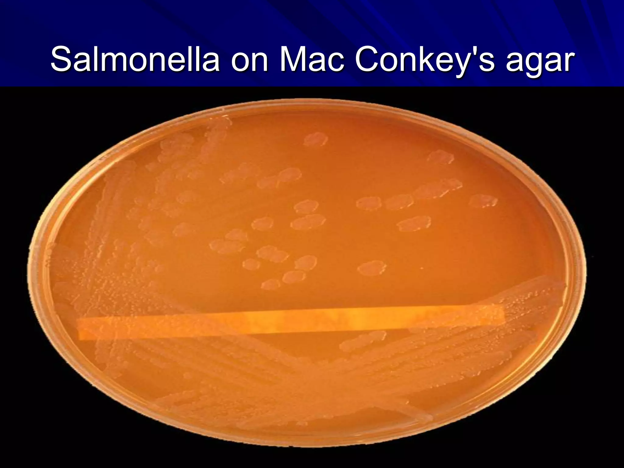 Salmonella on Mac Conkey's agar
 