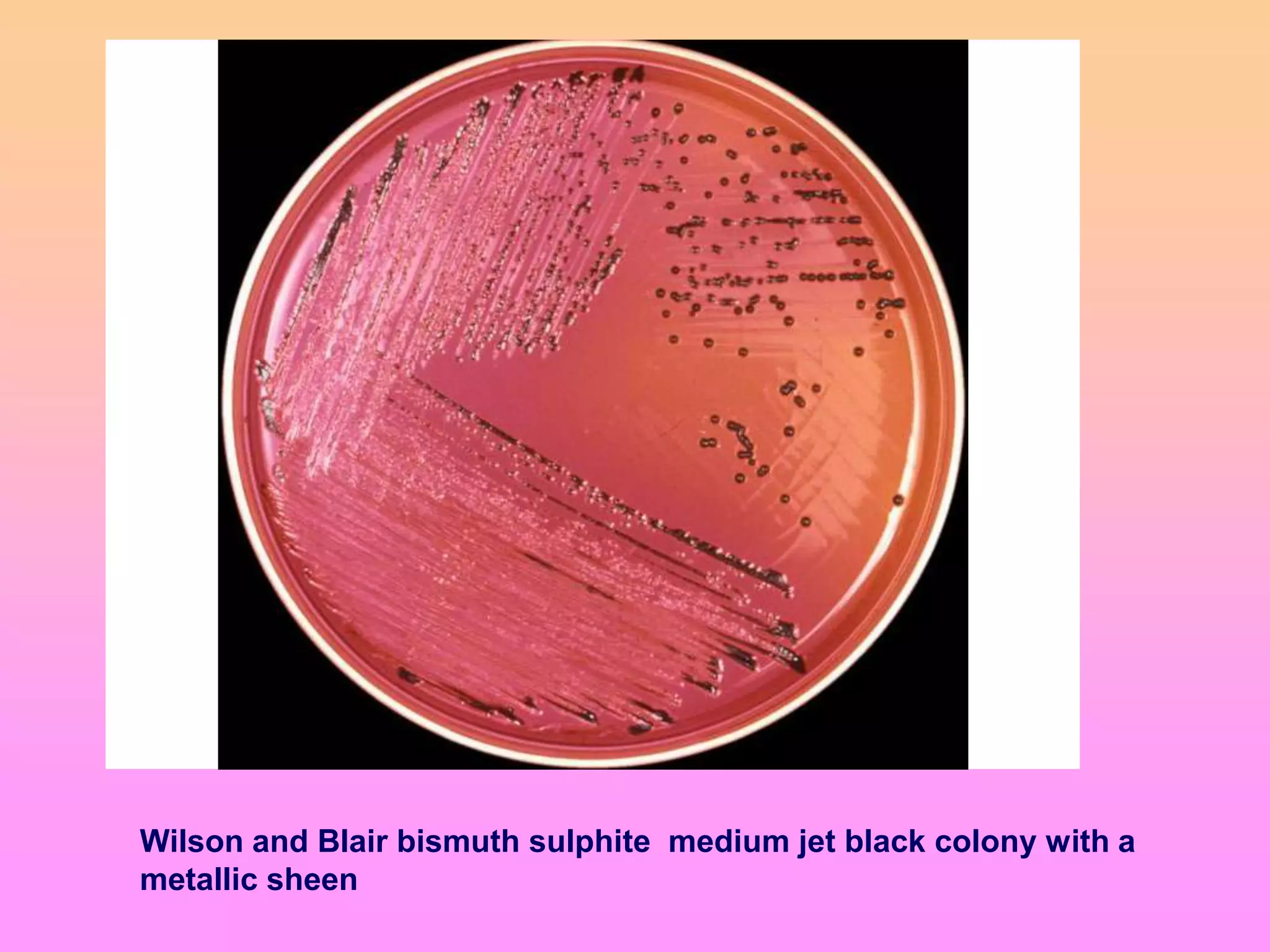 Wilson and Blair bismuth sulphite medium jet black colony with a
metallic sheen
 