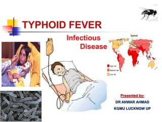 TYPHOID FEVER
Infectious
Disease
Presented by-
DR ANWAR AHMAD
KGMU LUCKNOW UP
 