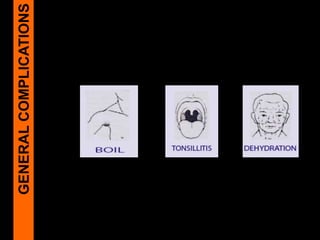 GENERALCOMPLICATIONS
 