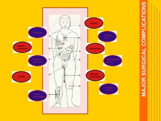 MAJORSURGICALCOMPLICATIONS
 