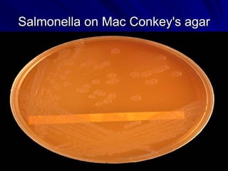 Salmonella on Mac Conkey's agar
 
