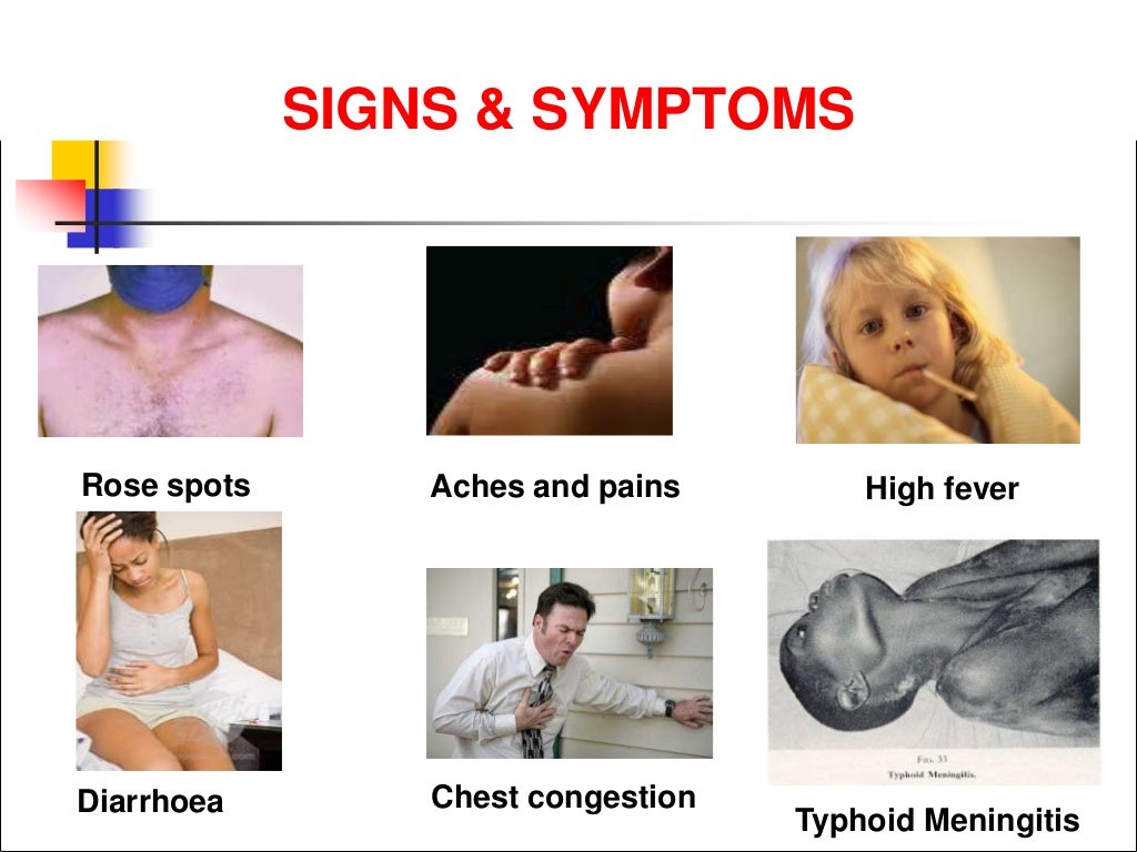 Typhoid fever ppt