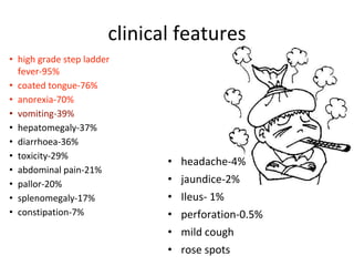 Typhoid presentations ppt dnb | PPTX
