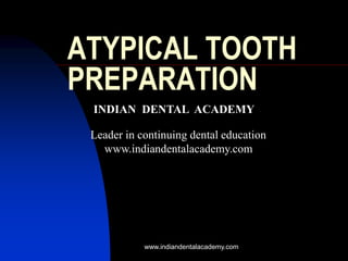 ATYPICAL TOOTH
PREPARATION
INDIAN DENTAL ACADEMY
Leader in continuing dental education
www.indiandentalacademy.com
www.indiandentalacademy.com
 