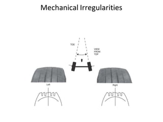 Mechanical Irregularities
 