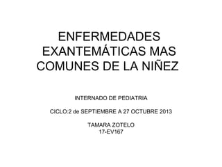 ENFERMEDADES
EXANTEMÁTICAS MAS
COMUNES DE LA NIÑEZ
INTERNADO DE PEDIATRIA
CICLO:2 de SEPTIEMBRE A 27 OCTUBRE 2013
TAMARA ZOTELO
17-EV167
 