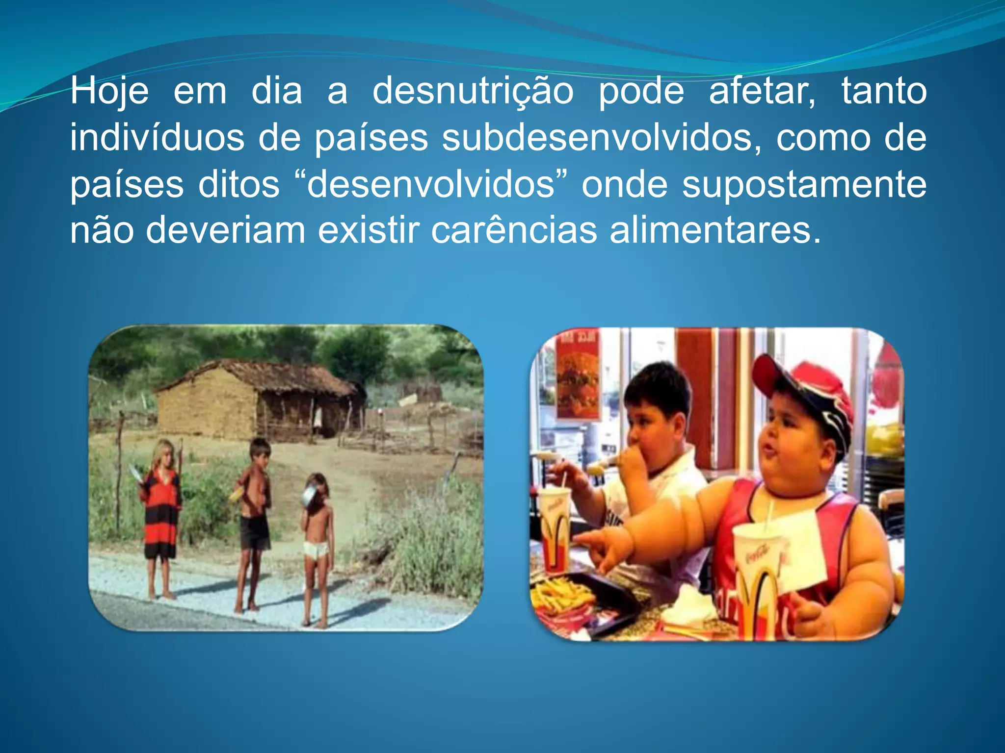 Hoje em dia a desnutrição pode afetar, tanto
indivíduos de países subdesenvolvidos, como de
países ditos “desenvolvidos” onde supostamente
não deveriam existir carências alimentares.
 