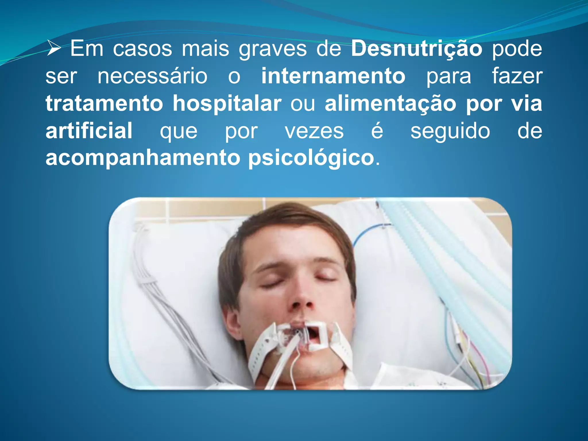  Em casos mais graves de Desnutrição pode
ser necessário o internamento para fazer
tratamento hospitalar ou alimentação por via
artificial que por vezes é seguido de
acompanhamento psicológico.
 