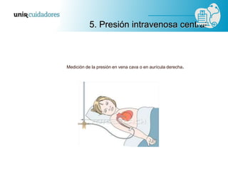Medición de la presión en vena cava o en aurícula derecha.
5. Presión intravenosa central
 
