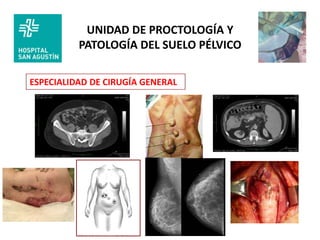 UNIDAD DE PROCTOLOGÍA Y
          PATOLOGÍA DEL SUELO PÉLVICO

ESPECIALIDAD DE CIRUGÍA GENERAL
 