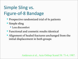 Simple Sling vs.
Figure-of-8 Bandage
  Prospective randomized trial of 61 patients
  Simple sling
    Less discomfort
  Functional and cosmetic results identical
  Alignment of healed fractures unchanged from the
  initial displacement in both groups




             Andersen et al., Acta Orthop Scand 58: 71-4, 1987.
 