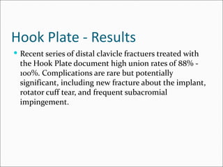 Hook Plate - Results
 Recent series of distal clavicle fractuers treated with
  the Hook Plate document high union rates of 88% -
  100%. Complications are rare but potentially
  significant, including new fracture about the implant,
  rotator cuff tear, and frequent subacromial
  impingement.
 
