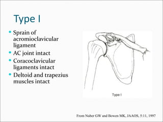 Type I
 Sprain of
  acromioclavicular
  ligament
 AC joint intact
 Coracoclavicular
  ligaments intact
 Deltoid and trapezius
  muscles intact




                          From Nuber GW and Bowen MK, JAAOS, 5:11, 1997
 