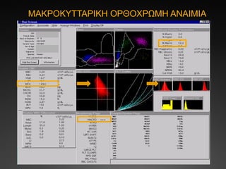 ΜΑΚΡΟΚΥΤΤΑΡΙΚΗ ΟΡΘΟΧΡΩΜΗ ΑΝΑΙΜΙΑ
 