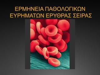 ΕΡΜΗΝΕΙΑ ΠΑΘΟΛΟΓΙΚΩΝ
ΕΥΡΗΜΑΤΩΝ ΕΡΥΘΡΑΣ ΣΕΙΡΑΣ
 