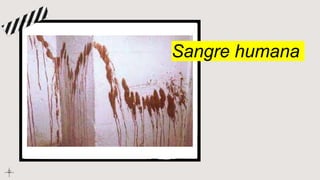 Sangre humana
 