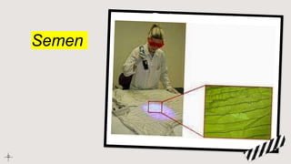 Semen
 