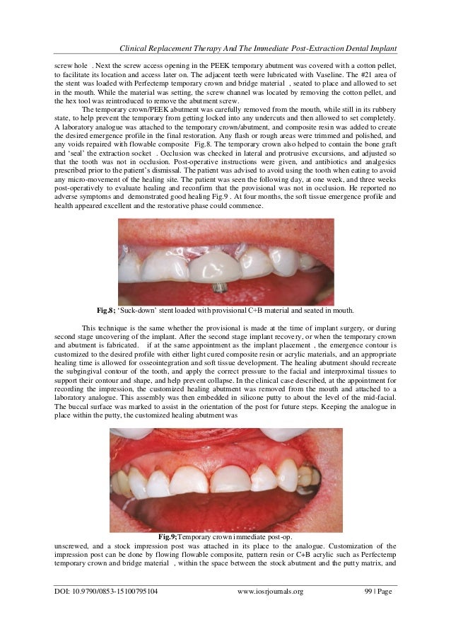 Clinical Replacement Therapy and the Immediate Postextraction Dental…