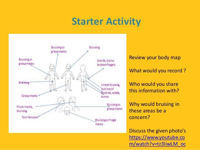 explain the rights that children and their carers have in situations where harm or abuse is suspecte Explain the rights that children, young people and their carers have in situations where harm or abuse is suspected or alleged explain ways of empowering children and young people to make positive and informed choices that support their well-being and safety. explain the rights that children and their carers have in situations where harm or abuse is suspecte Explain the rights that children, young people and their carers have in situations where harm or abuse is suspected or alleged explain ways of empowering children and young people to make positive and informed choices that support their well-being and safety.