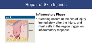 Repair of Skin Injuries
Inflammatory Phase
• Bleeding occurs at the site of injury
immediately after the injury, and
mast cells in the region trigger on
inflammatory response.
 