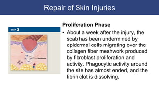 Repair of Skin Injuries
Proliferation Phase
• About a week after the injury, the
scab has been undermined by
epidermal cells migrating over the
collagen fiber meshwork produced
by fibroblast proliferation and
activity. Phagocytic activity around
the site has almost ended, and the
fibrin clot is dissolving.
 