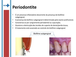 Periodontite
• É um processo inflamatório decorrente da presença do biofilme
subgengival;
• A presença do biofilme subgengival é determinada pelo exame profissional;
• Caracteriza-se por sangramento periodontal ou supuração;
• Ocasiona a destruição dos tecidos de suporte do dente/perda óssea;
• O tratamento está associado ao controle do biofilme subgengival.
Biofilme subgengival
 