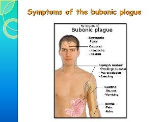 Symptoms of the bubonic plague
 