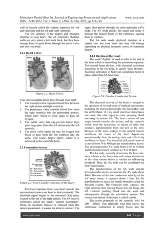 Denoising of ECG -- A discrete time approach using DWT | PDF